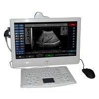On-platform, tabletop ultrasound system SIFULTRAS-4.1for gynecological and obstetric ultrasound imagingfor urology ultrasound imagingB/W