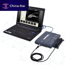Portable ultrasound system MD-320Wfor ophthalmic ultrasound imagingB/W