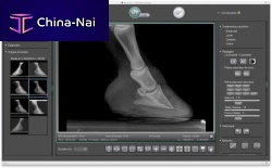 Veterinary radiology software ImedViewfor equinesfor veterinary clinicsfor telemedicine
