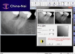 Dental imaging software Prof. Suniimage capturedata managementdiagnostic
