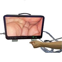 Endoscope video camera E43(C/0)medicalsurgicaldental