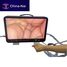 Endoscope video camera E43(C/0)medicalsurgicaldental