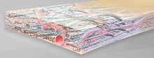 Buccal tissue matrix NovoMatrixxenograft