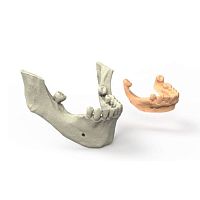 Dental software surgeryfor dental prosthesis designfor dental implant simulation