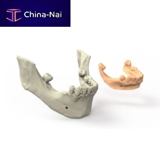 Dental software surgeryfor dental prosthesis designfor dental implant simulation