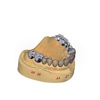 Dental restoration software DentalCADdesignCADtraining