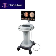 Non-mydriatic retinal camera SW-8000eye fluorescein angiographytrolley-mounted