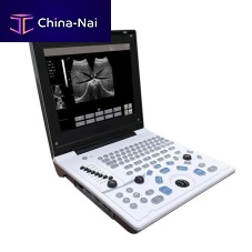 Portable ultrasound system 5520 for multipurpose ultrasound imagingB/Wbuilt-in console