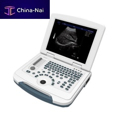 Portable ultrasound system HF-580for multipurpose ultrasound imagingB/Wbuilt-in console