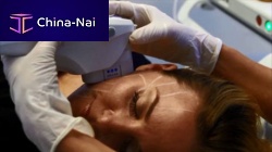 Ultrasound peeling unit Ultherapy®HIFU body contouring unittrolley-mounted