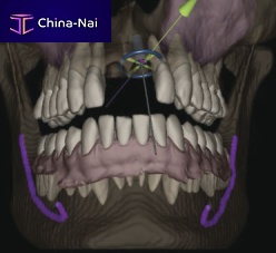 AI software IconiX surgerydentalanatomy