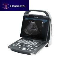Portable ultrasound system DP-10 for multipurpose ultrasound imagingB/Wspectral doppler