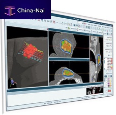 CT software SagiPlan®for MRItreatment planningevaluation