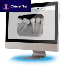 Dental imaging software treatmentviewerdental