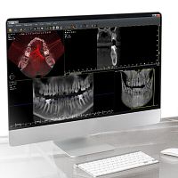 Dental imaging software QuickVision 3Dfor dental implantologyvisualizationanalysis