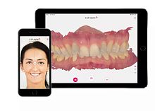 Digital smile design software Smile Designdentaltreatmentscan