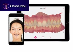 Digital smile design software Smile Designdentaltreatmentscan