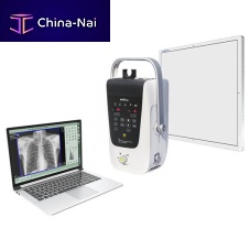 Portable radiography system Beatle-02P digitalfor chest radiographywithout table