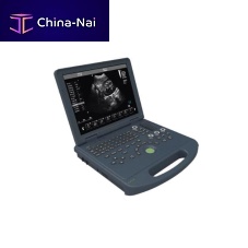 Portable ultrasound system HF-L3for multipurpose ultrasound imagingB/Wcolor doppler