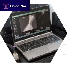 Veterinary radiography acquisition system MUSICA DRportable