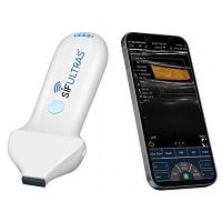 Hand-held ultrasound system SIFULTRAS-3.35for skin ultrasound imagingcolor dopplerwireless probe