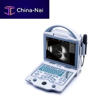 Portable ultrasound system ODU5for ophthalmic ultrasound imagingB/W