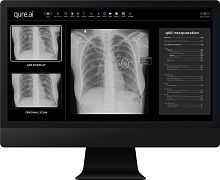Radiology software qXRreportinginterpretationscreening