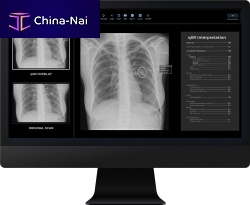Radiology software qXRreportinginterpretationscreening