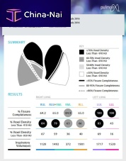 CT software StratX®analysisreportingmeasurement