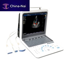 Portable ultrasound system TH-5100for multipurpose ultrasound imagingcolor dopplerbuilt-in console