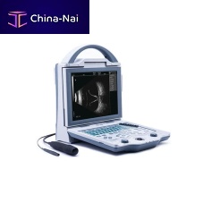 Portable ultrasound system ODU5for ophthalmic ultrasound imagingB/Wbuilt-in console