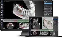 Medical software Implant 3Dfor dental surgeryCTfor guided surgery
