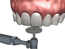 Dental surgery software NA501 periodontaltreatmenteducation