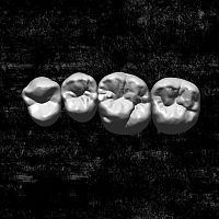 Dental restoration software Library3D simulationCADCAM