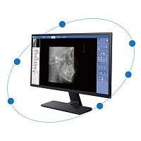 Medical imaging software CephPro3Dorthodonticclinicalanalysis