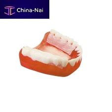 Buccal tissue matrix RetissuePLA