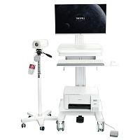 Video colposcope SY01trolley-mounted