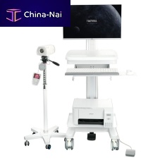 Video colposcope SY01trolley-mounted