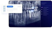 Dental surgery software Allisonefor dental implantologyfor x-ray imagingvisualization