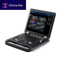 Portable ultrasound system M60 for multipurpose ultrasound imagingB/Wcolor doppler