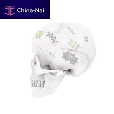 Non-absorbable cranial fixation system MatrixNEURO