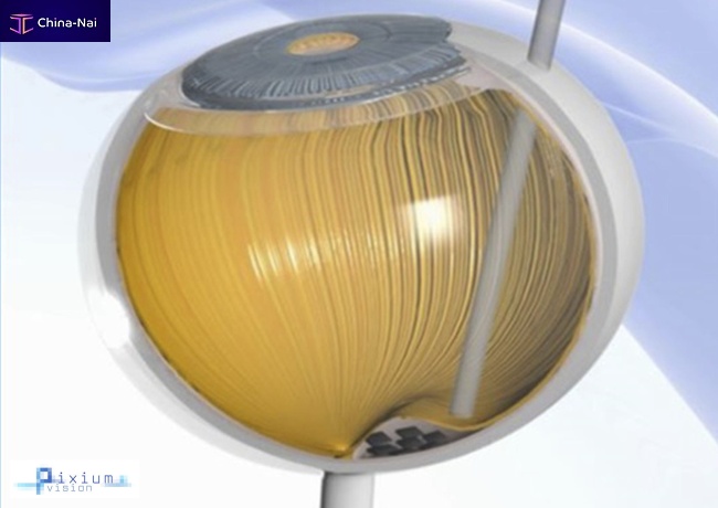 											Subretinal implant PRIMA