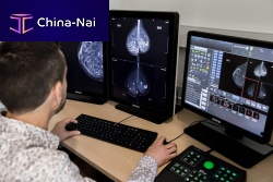 Mammography software Breast-SlimViewdiagnosticfor breast cancer screeningmachine learning