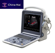 Portable ultrasound system K2for multipurpose ultrasound imagingB/Wcolor doppler