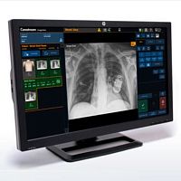 Medical imaging software ImageViewanalysisdiagnosticacquisition