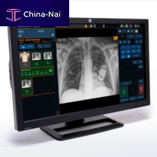 Medical imaging software ImageViewanalysisdiagnosticacquisition