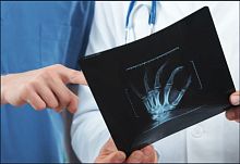 Radiography software VUNO Med®-BoneAgediagnosticevaluationAI-assisted